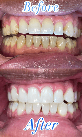 Dental hygienist