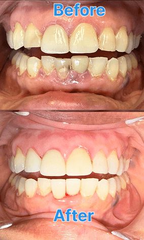 Dental assistant